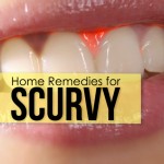 home remedy for scurvy