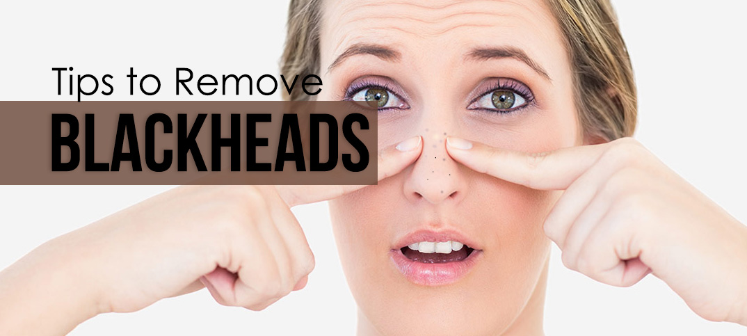 tips to remove blackheads