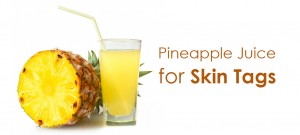 pineapple juice for skin tags