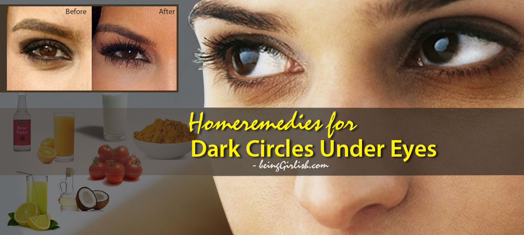 home remedies for dark circles under eyes