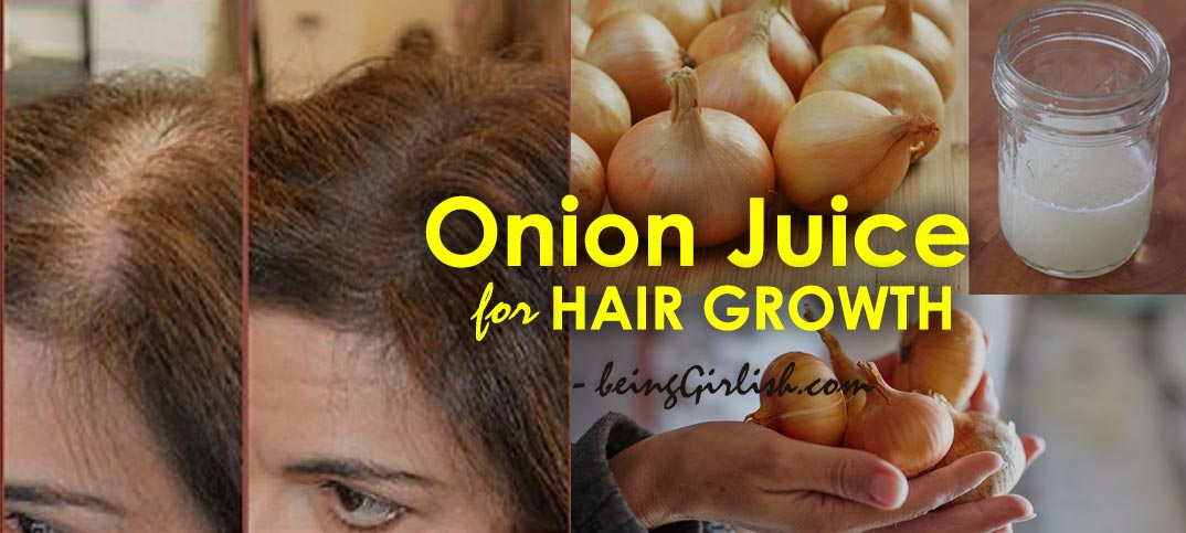 onion juice for hair growth